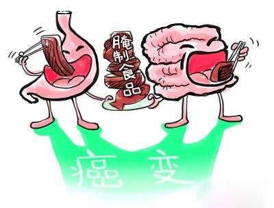 <b>你了解重视胃肠*吗</b>