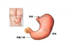 引发胃炎的病因有哪些呢