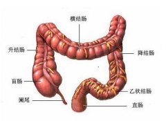 结肠炎能治好吗?