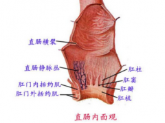 <b>直肠炎有哪些致病原因呢 ?</b>