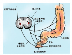 直肠炎患者饮食应该注意什么？