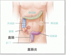 哪些原因导致急性肠炎?
