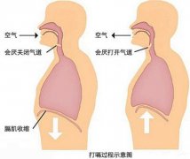 打嗝的主要症状有哪些