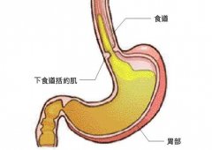 <b>胃反酸的症状有哪些</b>