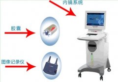胶囊内镜