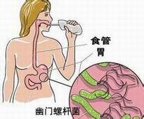 <b> 幽门螺杆菌会传染吗？</b>