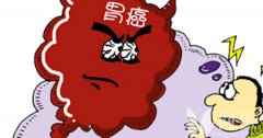 胃部*变的5个信号要认清！