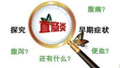 诱发直肠炎的发生的六大因素